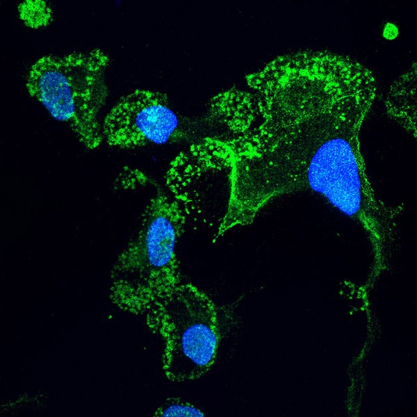 Mikroglia (grün), die im Labor aus Stammzellen von ALS-Patienten "gereift" wurden; die Zellkerne sind blau. Betrachtet mit konfokaler Mikroskopie